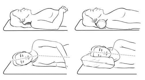 Best Posture to Sleep for Neck Pain - Dowager's Hump Pillow & Position 