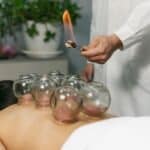 Cupping Therapy for Stress and Anxiety Relief: A Natural Solution