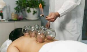 Cupping Therapy for Stress and Anxiety Relief: A Natural Solution