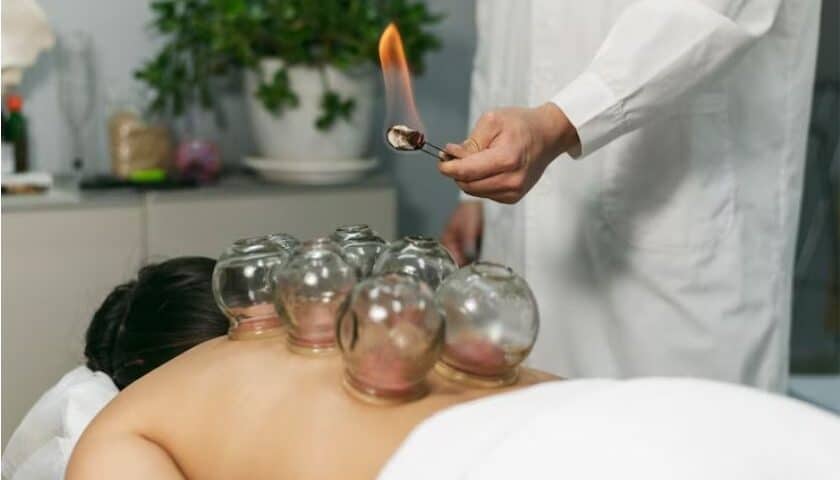 Cupping Therapy for Stress and Anxiety Relief: A Natural Solution