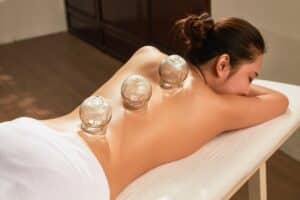 cupping-therapy-in-Beverly-Hills